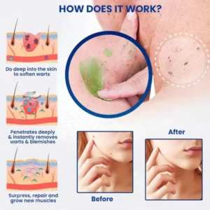 Elycura™ NatureErase: Erase Unwanted Marks in 7 Days Without Surgery, Pain, or $650 Doctor Bills