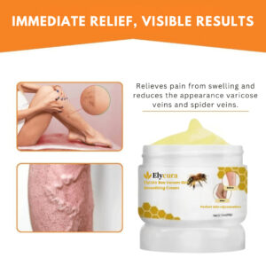 Elycura™ Anti-Varicose Cream | Varicose Veins Disappear from the First Use!