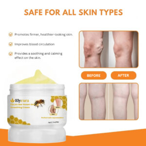 Elycura™ Anti-Varicose Cream | Varicose Veins Disappear from the First Use!