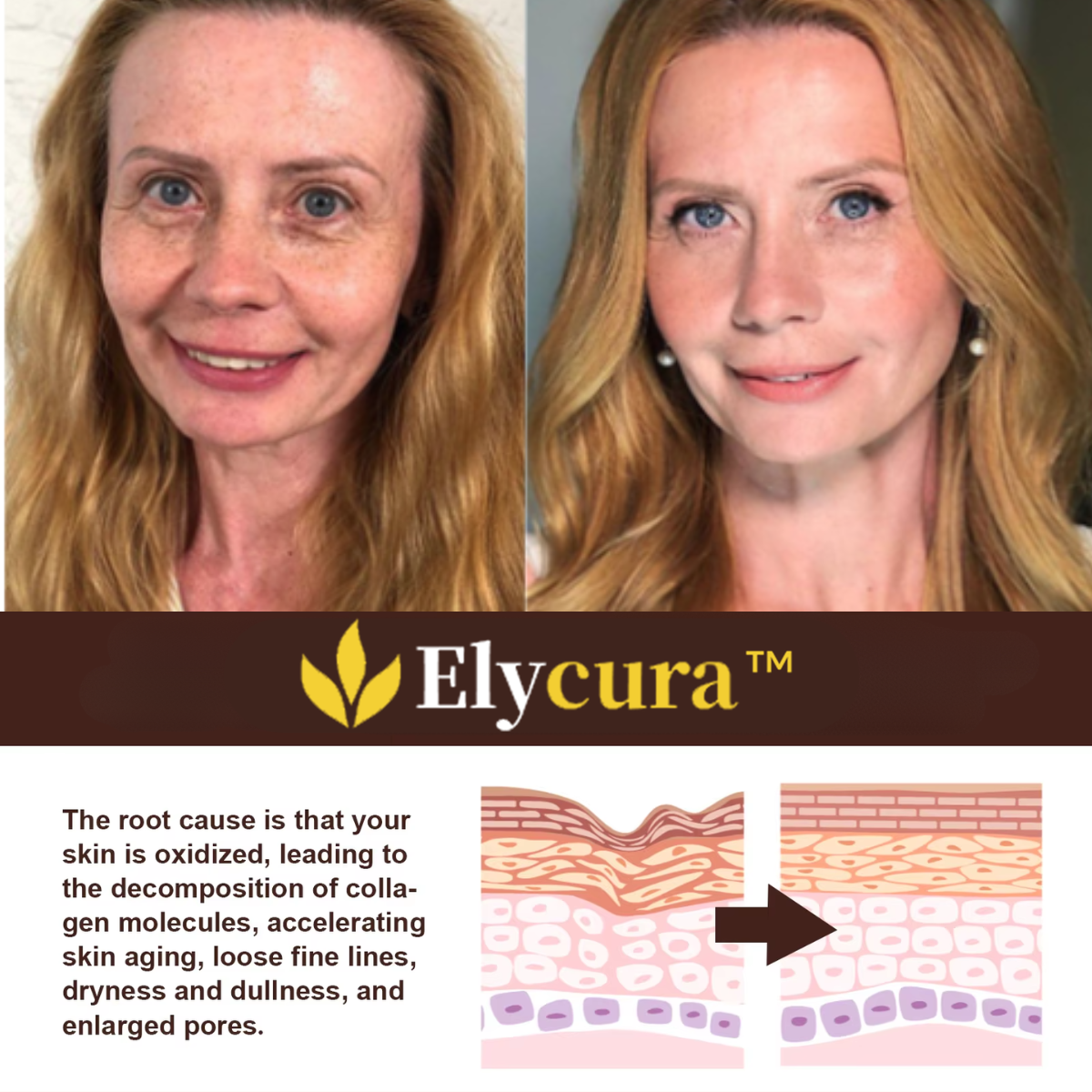 Elycura™ | Erase 98% of Wrinkles & Look 15 Years Younger in Just 7 Days!
