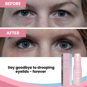 Elycura | Achieve 87% Firmer, Lifted Eyelids in Just 2 Hours