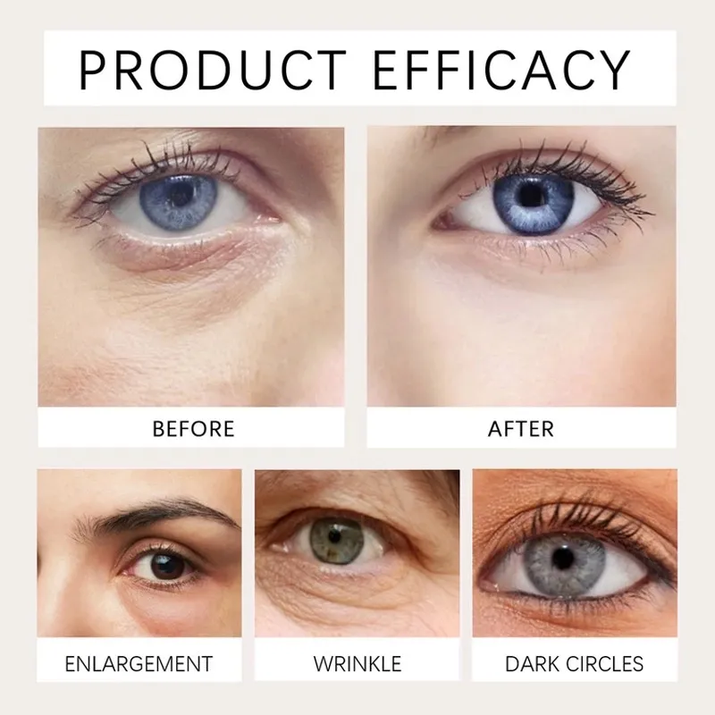 Elycura™ The Instant Eye Lift That Doesn't Betray You When You Smile