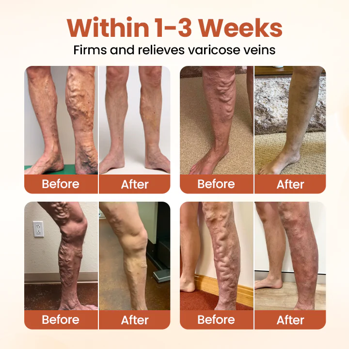ODALIT™ VeinTarget Microneedle Patch