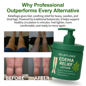Relieflogix™ EDEMA RELIEF LOTION
