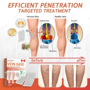 Zvoevo® Vein Ease Microneedle Care Patch