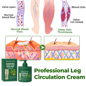 Relieflogix™ EDEMA RELIEF LOTION