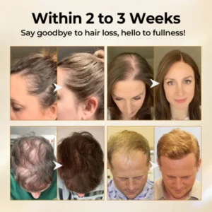 Acezozla® CollagenGrow Peptides Hair Growth Spray