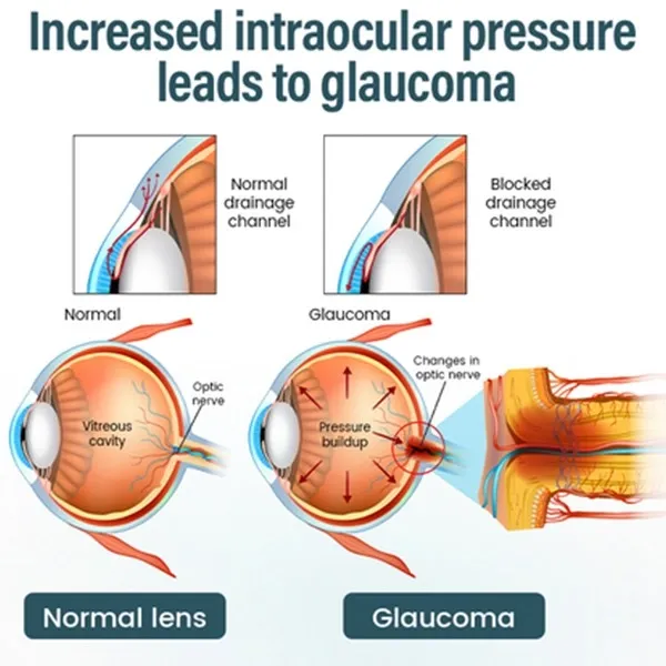 Elycura™ NANO Eye Drops Serum