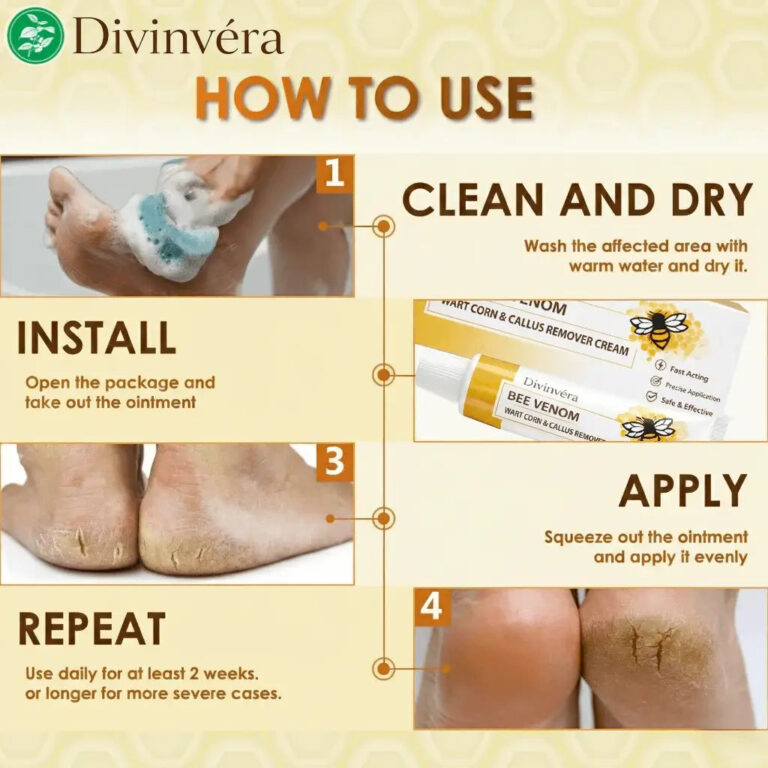Divinvéra BEE VENOM WART CORN & CALLUS REMOVER CREAM