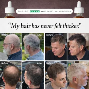 Keapers™ FST-5 Peptide Complex Advanced Hair Regrowth Solution