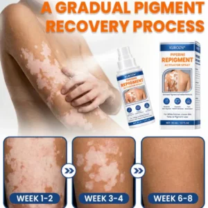 KUBOZN® Piperine Repigment Activator Spray