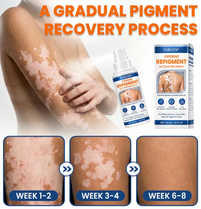 KUBOZN® Piperine Repigment Activator Spray