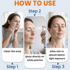 KUBOZN® Piperine Repigment Activator Spray