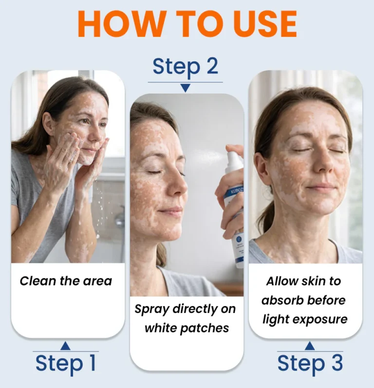 KUBOZN® Piperine Repigment Activator Spray