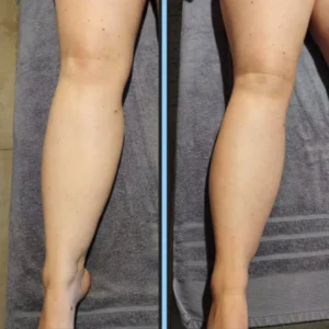 Nerova Lymphatic Drainage Drops