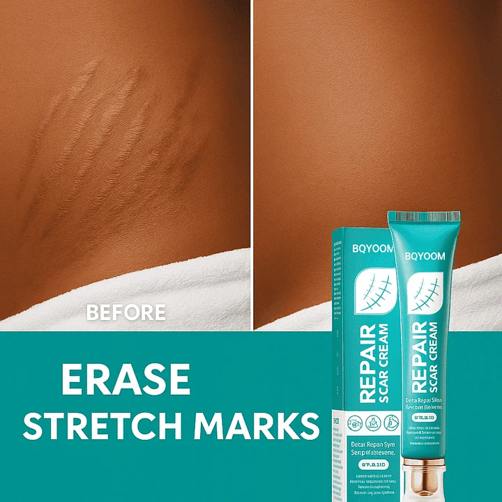 BQYOOM Scar Cream – Fade old scars, stretch marks & burns naturally