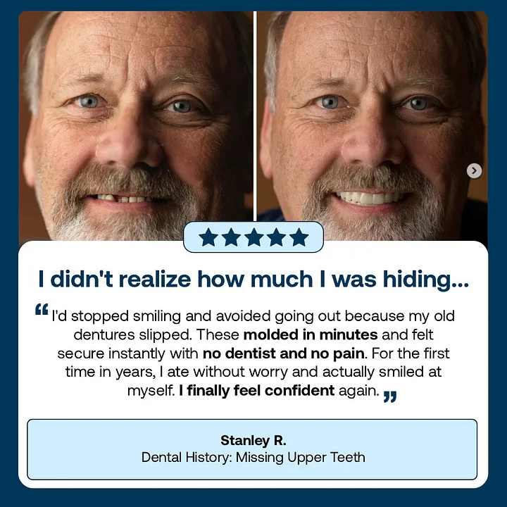 YUNPSO™ Custom-Fit Full Functional Dentures