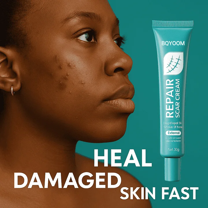 BQYOOM Scar Cream – Fade old scars, stretch marks & burns naturally