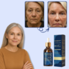 DermaLisse™ Lift Serum | Lift your face without botox in 1 week!
