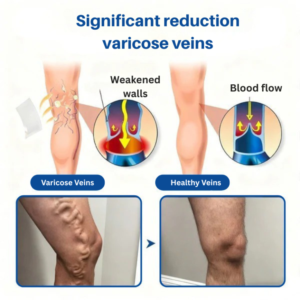 Venalix Microneedle Patch
