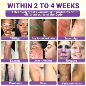 Timilk® Biotin 10-in-1 Skin Restoration Cream