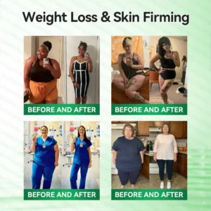 MOPRO Slimming Patch Moringa Berberine NAD+ Microneedle