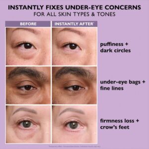PERFECTIONTHOMASROTH Instant Eye Temporary Eye Tightener