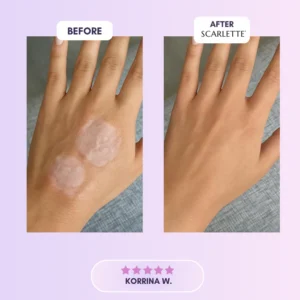 Scarlette™ Silicone Collagen Sheets