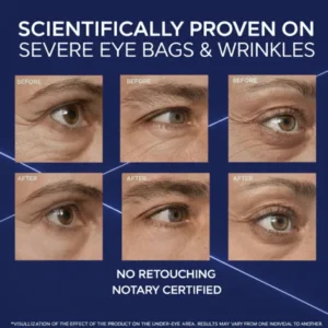 BARUBT Eye Skincare Under-Eye Bag Cream