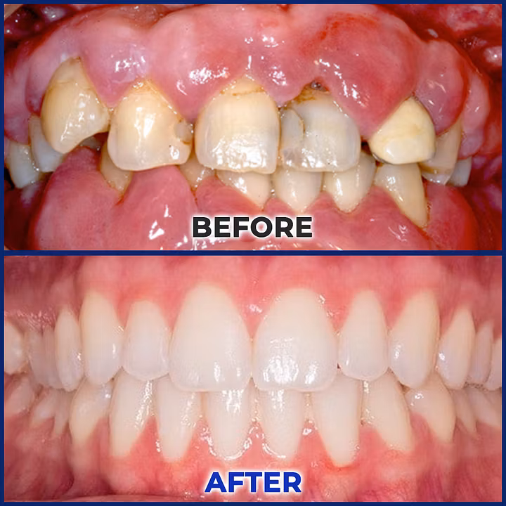 BQYOOM® BeeTakt Oral Repair Solution