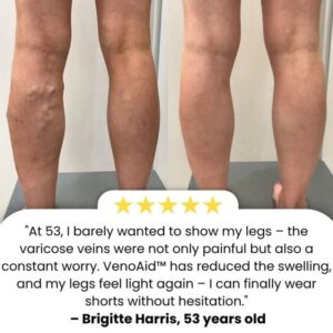 BioEquis Vein Relief Spray