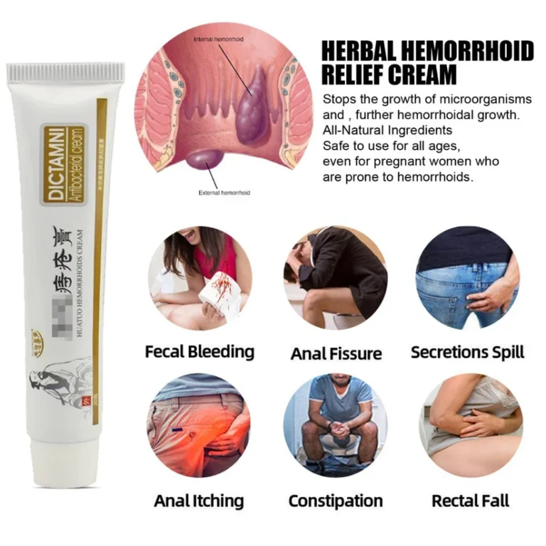 Dictmni™ – PileRelief Herbal Cream