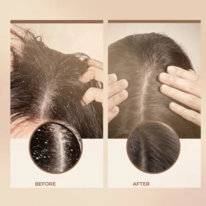 RebloomRituals Dry Shampoo Buildup Scalp Scrub