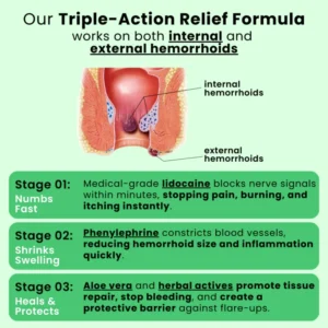illura® Advanced Hemorrhoid Relief Cream