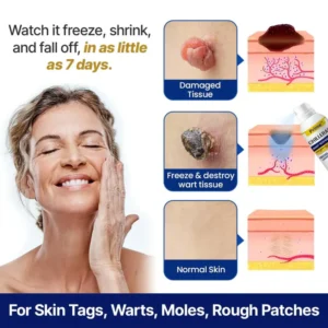 Prime® ChillErase Bump Renewal Spray