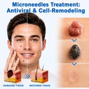Curalona Microneedle Clear Patches