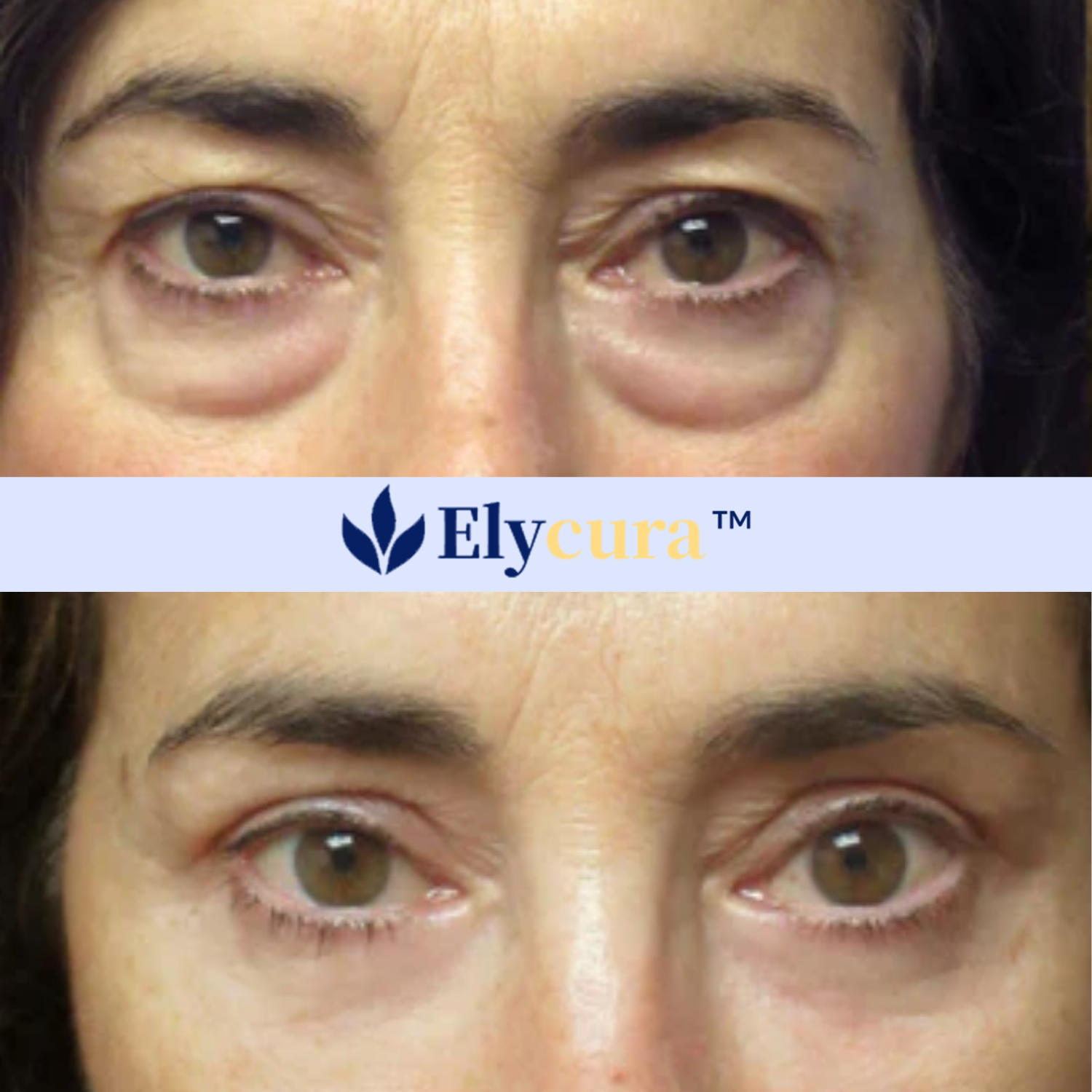 Elycura Liquid Solution Anti-Aging Serum