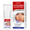KUBOZN® Vitiligo Treatment Spray